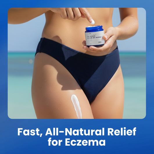 The Ocean Healed My Eczema