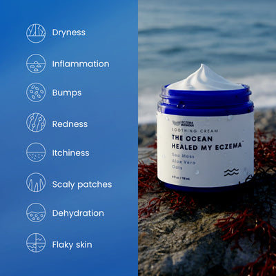 The Ocean Healed My Eczema