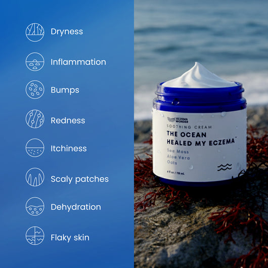 The Ocean Healed My Eczema